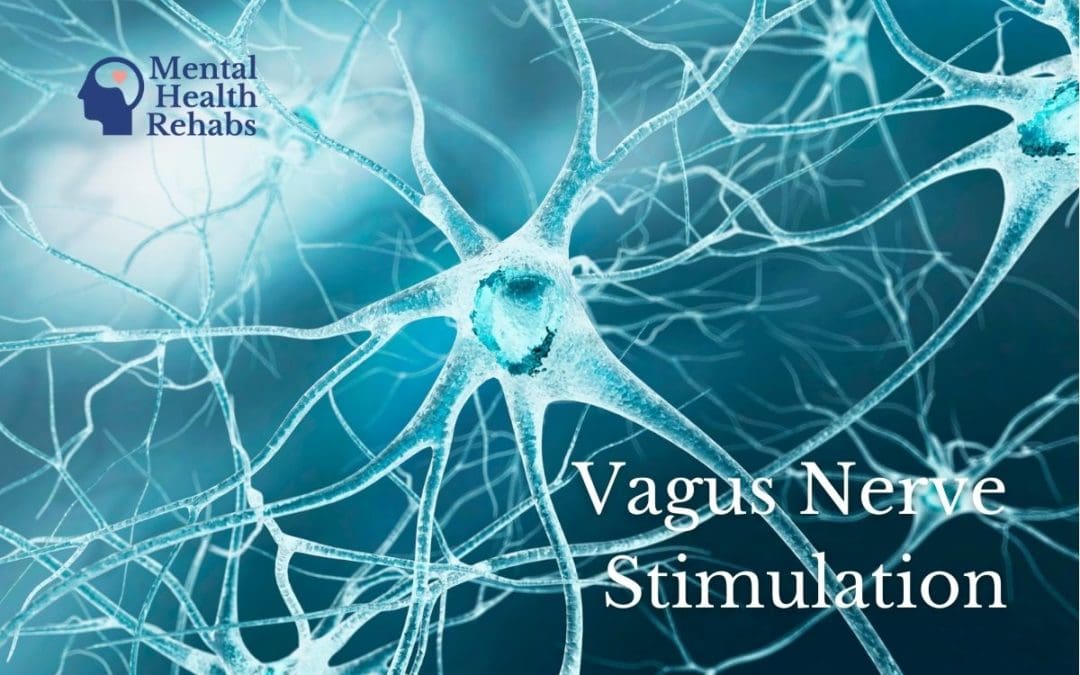 vagus-nerve-stimulation