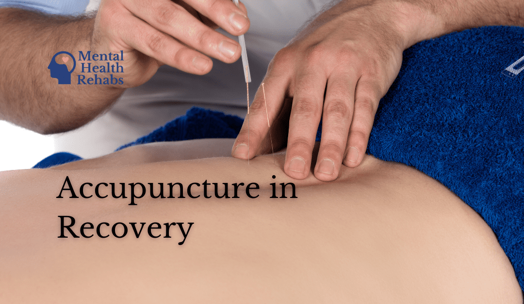 Acupuncture in Recovery